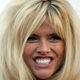 Anna Nicole's Doctor And Sleazy Live-In Lawyer Escape Felony Convictions